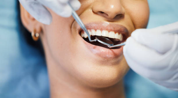 Best Emergency Treatment for Dental Infections or Abscesses in Groves, TX