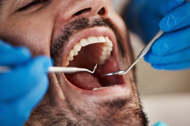 Best Pediatric Emergency Dentist in Groves, TX